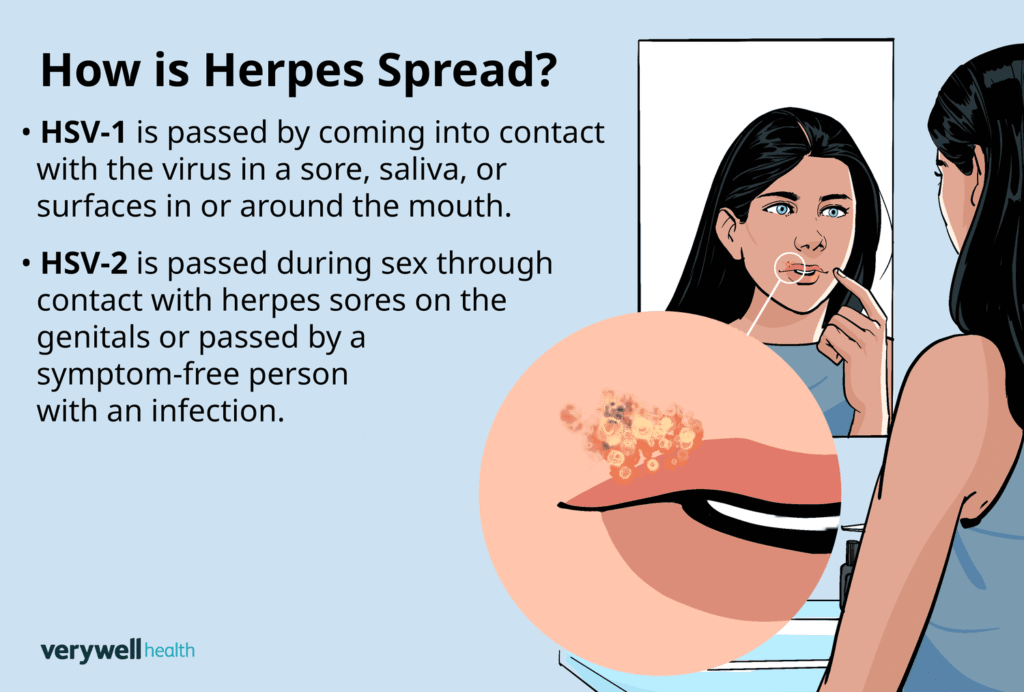 Herpes Photos in Different Stages